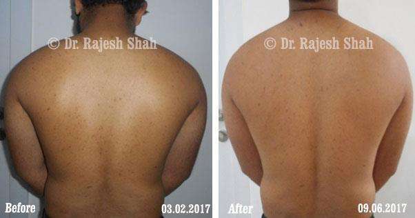 lifeforce homeopathy case-photos
